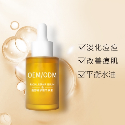 吉安市_祛痘精华原液OEM